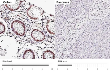 Anti-UBR7 antibody [HL6568] used in IHC (Paraffin sections) (IHC-P). GTX649038