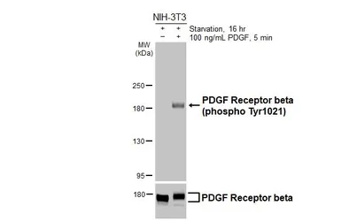 Anti-PDGF Receptor beta (phospho Tyr1021) antibody [HL6575] used in Western Blot (WB). GTX649045