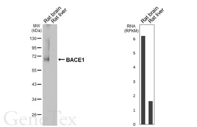 Anti-BACE1 antibody [HL6578] used in Western Blot (WB). GTX649048
