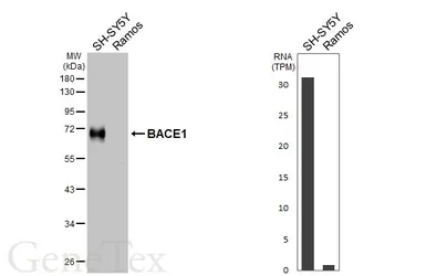 Anti-BACE1 antibody [HL6578] used in Western Blot (WB). GTX649048