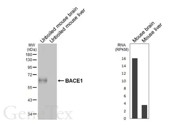 Anti-BACE1 antibody [HL6578] used in Western Blot (WB). GTX649048