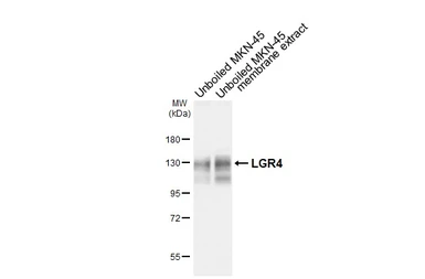 Anti-LGR4 antibody [HL6583] used in Western Blot (WB). GTX649053