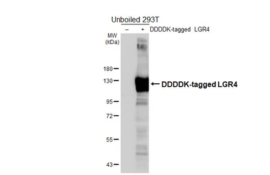 Anti-LGR4 antibody [HL6583] used in Western Blot (WB). GTX649053