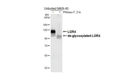 Anti-LGR4 antibody [HL6583] used in Western Blot (WB). GTX649053