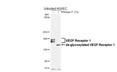 Anti-VEGF Receptor 1 antibody [HL6585] used in Western Blot (WB). GTX649055
