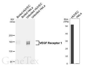 Anti-VEGF Receptor 1 antibody [HL6585] used in Western Blot (WB). GTX649055