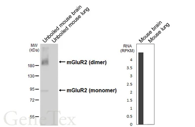 Anti-mGluR2 antibody [HL6586] used in Western Blot (WB). GTX649056