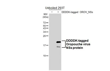 Anti-Oropouche virus NSs protein antibody [HL6587] used in Western Blot (WB). GTX649057