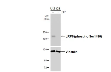 Anti-LRP6 (phospho Ser1490) antibody [HL6592] used in Western Blot (WB). GTX649062