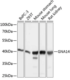 Anti-GNA14 antibody used in Western Blot (WB). GTX64910