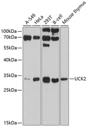 Anti-UCK2 antibody used in Western Blot (WB). GTX64911