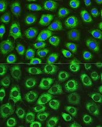 Anti-DNAJC10 antibody used in Immunocytochemistry/ Immunofluorescence (ICC/IF). GTX64912