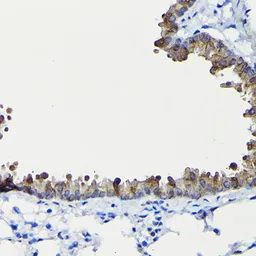 Anti-FUCA2 antibody used in IHC (Paraffin sections) (IHC-P). GTX64913