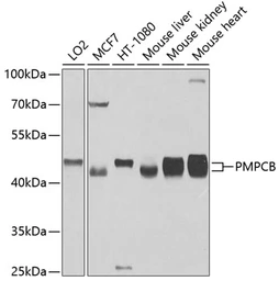 Anti-PMPCB antibody used in Western Blot (WB). GTX64915
