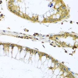Anti-PMPCB antibody used in IHC (Paraffin sections) (IHC-P). GTX64915