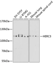Anti-HERC3 antibody used in Western Blot (WB). GTX64920