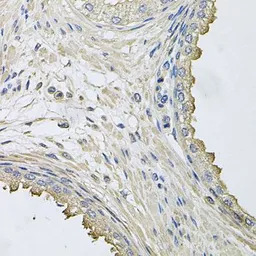 Anti-HERC3 antibody used in IHC (Paraffin sections) (IHC-P). GTX64920