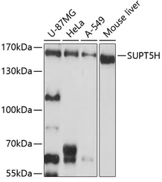 Anti-SUPT5H antibody used in Western Blot (WB). GTX64922