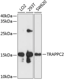 Anti-TRAPPC2 antibody used in Western Blot (WB). GTX64923