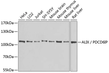 Anti-ALIX antibody used in Western Blot (WB). GTX64925