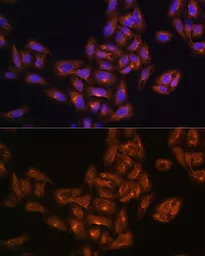 Anti-ALIX antibody used in Immunocytochemistry/ Immunofluorescence (ICC/IF). GTX64925