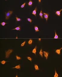 Anti-ALIX antibody used in Immunocytochemistry/ Immunofluorescence (ICC/IF). GTX64925