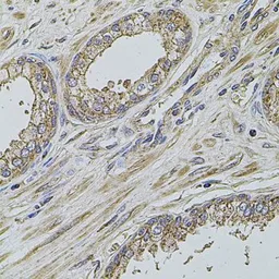 Anti-ALIX antibody used in IHC (Paraffin sections) (IHC-P). GTX64925