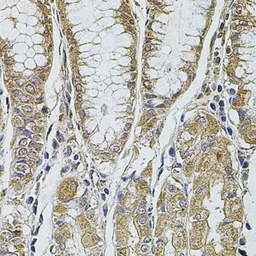 Anti-ALIX antibody used in IHC (Paraffin sections) (IHC-P). GTX64925