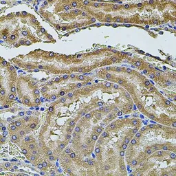 Anti-ALIX antibody used in IHC (Paraffin sections) (IHC-P). GTX64925