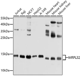 Anti-MRPL32 antibody used in Western Blot (WB). GTX64927