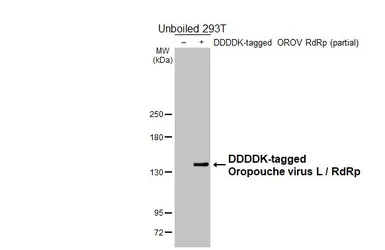 Anti-Oropouche virus L / RdRp antibody [HL6600] used in Western Blot (WB). GTX649300