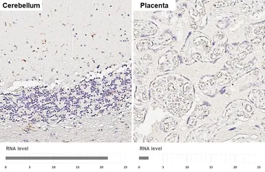 Anti-CX3CR1 antibody [HL6609] used in IHC (Paraffin sections) (IHC-P). GTX649309