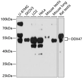 Anti-DDX47 antibody used in Western Blot (WB). GTX64931