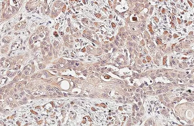 Anti-JAK2 antibody [HL6611] used in IHC (Paraffin sections) (IHC-P). GTX649311