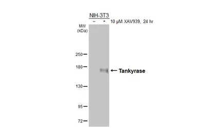 Anti-Tankyrase antibody [HL6612] used in Western Blot (WB). GTX649312