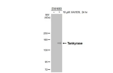 Anti-Tankyrase antibody [HL6612] used in Western Blot (WB). GTX649312