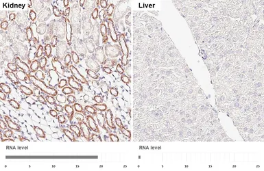 Anti-Hexokinase 1 antibody [HL6617] used in IHC (Paraffin sections) (IHC-P). GTX649317
