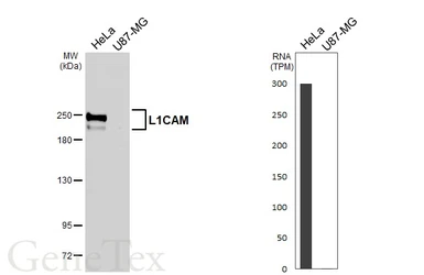 Anti-L1CAM antibody [HL6618] used in Western Blot (WB). GTX649318