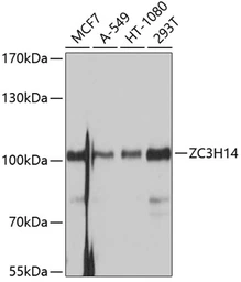Anti-ZC3H14 antibody used in Western Blot (WB). GTX64932