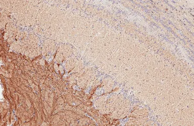 Anti-L1CAM antibody [HL6620] used in IHC (Paraffin sections) (IHC-P). GTX649320