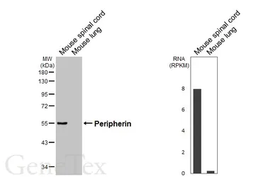 Anti-Peripherin antibody [HL6621] used in Western Blot (WB). GTX649321