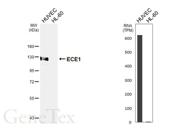 Anti-ECE1 antibody [HL6623] used in Western Blot (WB). GTX649323