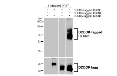 Anti-CLCN5 antibody [HL6625] used in Western Blot (WB). GTX649325