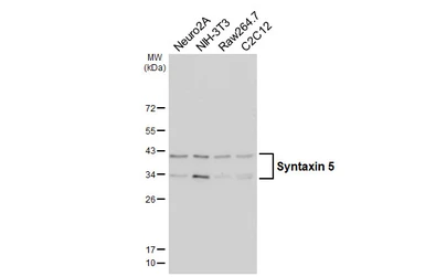 Anti-Syntaxin 5 antibody [HL6627] used in Western Blot (WB). GTX649327
