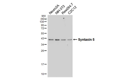 Anti-Syntaxin 5 antibody [HL6629] used in Western Blot (WB). GTX649329