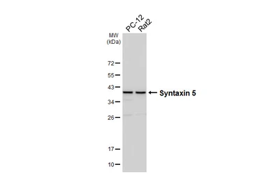 Anti-Syntaxin 5 antibody [HL6629] used in Western Blot (WB). GTX649329