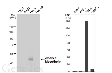 Anti-Mesothelin antibody [HL6631] used in Western Blot (WB). GTX649331