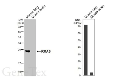 Anti-RRAS antibody [HL6633] used in Western Blot (WB). GTX649333