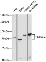 Anti-IKB zeta antibody used in Western Blot (WB). GTX64934