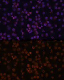 Anti-IKB zeta antibody used in Immunocytochemistry/ Immunofluorescence (ICC/IF). GTX64934